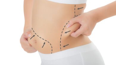 Liposuction Yağ Aldırma